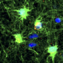 Reactive astrocytes, Kampmann lab