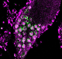 Prosaposin-deficient neurons accumulating dysfunctional lysosomes