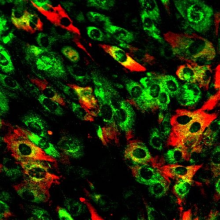 Two types of reactive inflammatory astrocytes. Kun Leng, Kampmann Lab