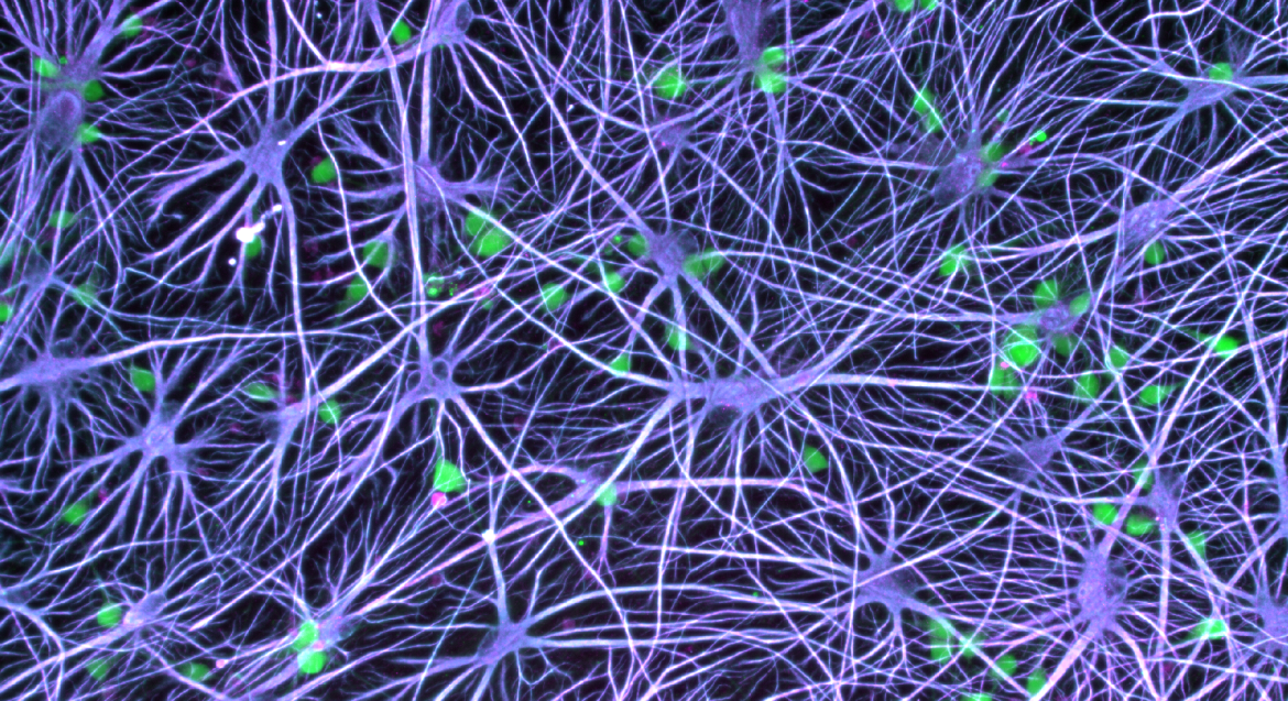 Kampmann lab astrocytes neurons