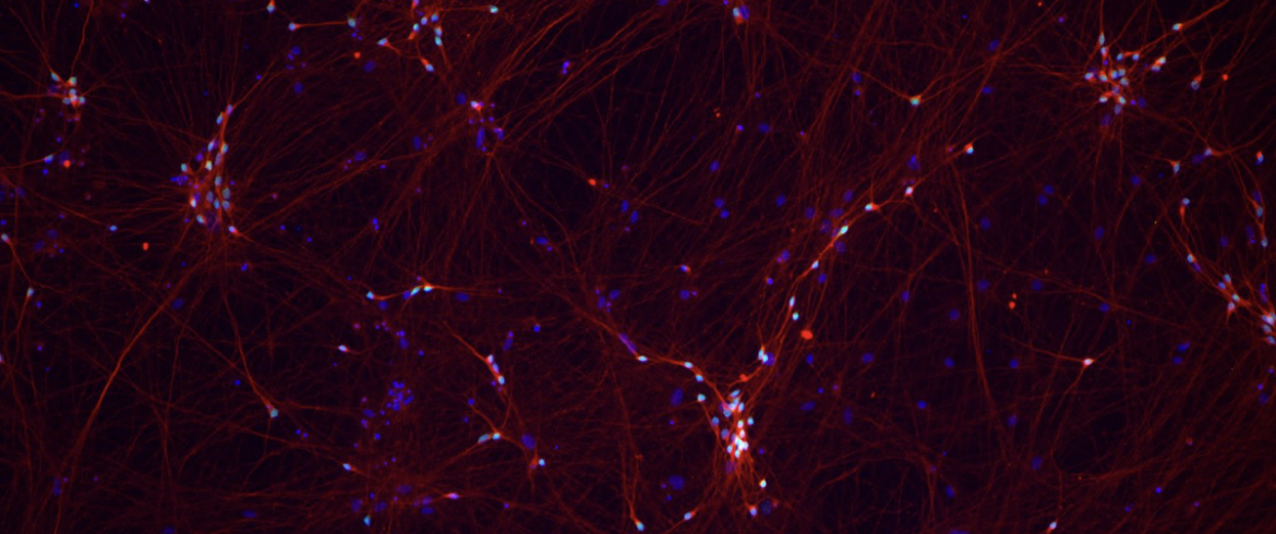 Kampmann Lab neurons