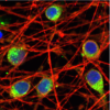 Human iPSC-derived neurons